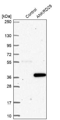 Western Blot: ANKRD29 Antibody [NBP2-30674]