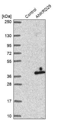 Western Blot: ANKRD29 Antibody [NBP2-33564]