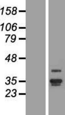 Western Blot: ANKRD29 Overexpression Lysate [NBL1-07538]