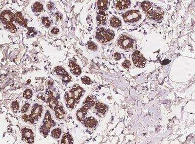 Immunohistochemistry-Paraffin: ANKRD30B Antibody [NBP3-05957]