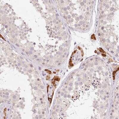 Immunohistochemistry-Paraffin: ANKRD31 Antibody [NBP2-49261]