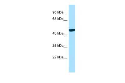 Western Blot: ANKRD33 Antibody [NBP2-84429]