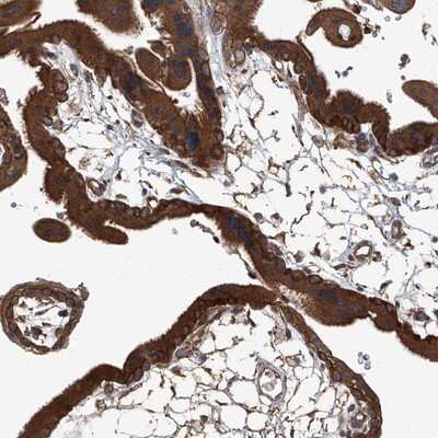 Immunohistochemistry-Paraffin: ANKRD34A Antibody [NBP1-90856]