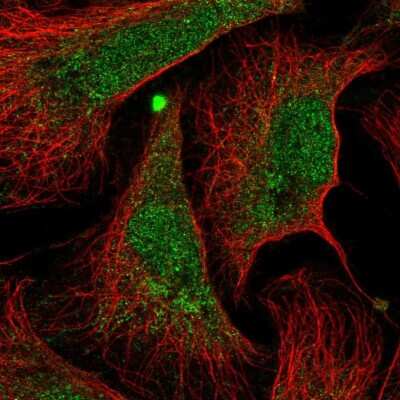 Immunocytochemistry/ Immunofluorescence: ANKRD34B Antibody [NBP1-90487]