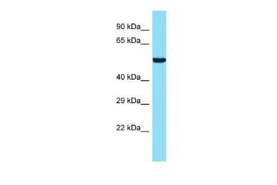 Western Blot: ANKRD34B Antibody [NBP2-82609]