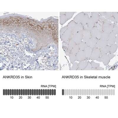 Immunohistochemistry-Paraffin: ANKRD35 Antibody [NBP1-93924]