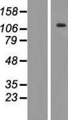 Western Blot: ANKRD35 Overexpression Lysate [NBP2-05534]