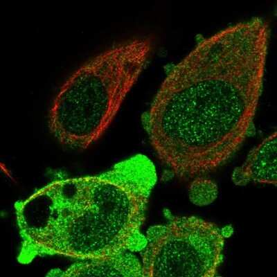 Immunocytochemistry/ Immunofluorescence: ANKRD36 Antibody [NBP2-56995]