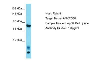 Western Blot: ANKRD36 Antibody [NBP2-82611]