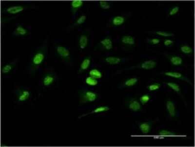 Immunocytochemistry/ Immunofluorescence: ANKRD37 Antibody (6E8) [H00353322-M02]