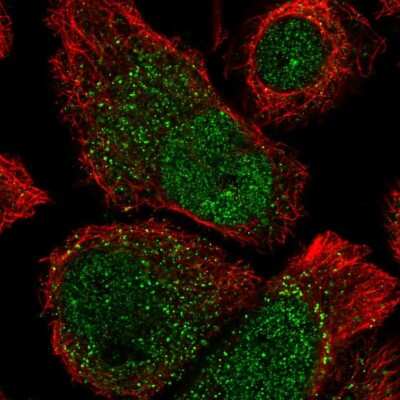 Immunocytochemistry/ Immunofluorescence: ANKRD37 Antibody [NBP2-58724]