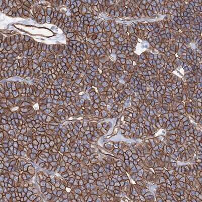 Immunohistochemistry-Paraffin: ANKRD37 Antibody [NBP1-82819]