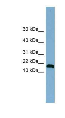 Western Blot: ANKRD37 Antibody [NBP1-55347]