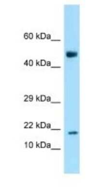 Western Blot: ANKRD37 Antibody [NBP1-98583]