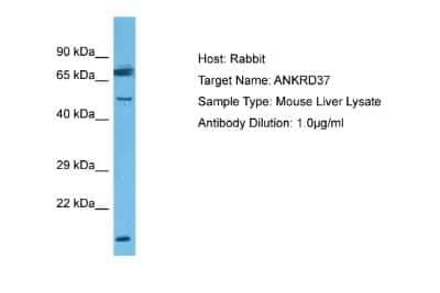 Western Blot: ANKRD37 Antibody [NBP1-98583]