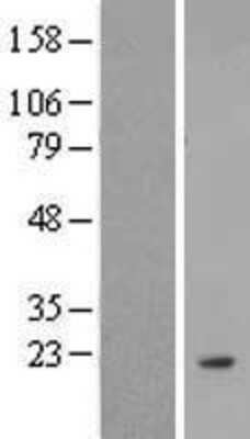 Western Blot: ANKRD37 Overexpression Lysate [NBL1-07540]