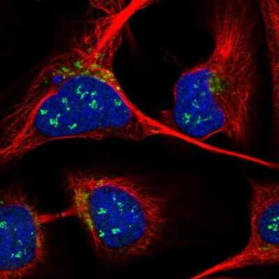 Immunocytochemistry/ Immunofluorescence: ANKRD40 Antibody [NBP1-93516]