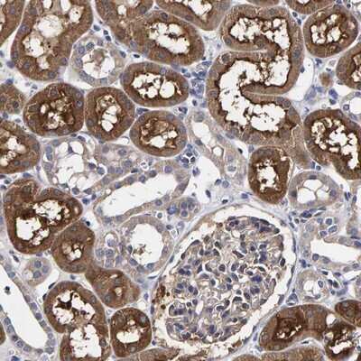 Immunohistochemistry-Paraffin: ANKRD40 Antibody [NBP1-93515]