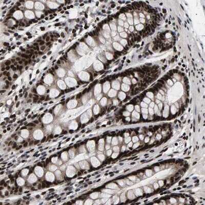 Immunohistochemistry-Paraffin: ANKRD40 Antibody [NBP1-93516]