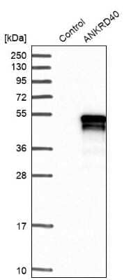 Western Blot: ANKRD40 Antibody [NBP1-93515]