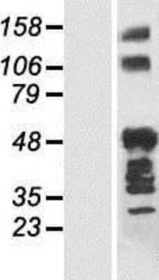 Western Blot: ANKRD40 Overexpression Lysate [NBP2-05852]