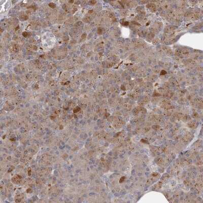 Immunohistochemistry-Paraffin: ANKRD44 Antibody [NBP1-80887]