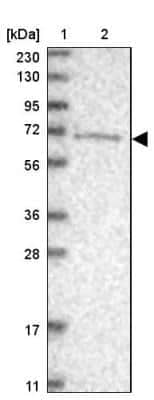 Western Blot: ANKRD44 Antibody [NBP1-80887]