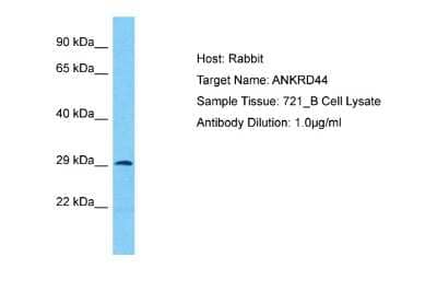 Western Blot: ANKRD44 Antibody [NBP2-84431]