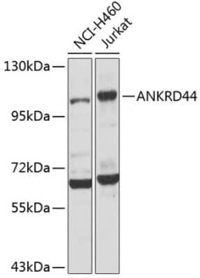 Western Blot: ANKRD44 AntibodyBSA Free [NBP2-92554]