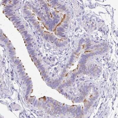 Immunohistochemistry-Paraffin: ANKRD45 Antibody [NBP1-85421]