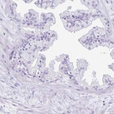 Immunohistochemistry-Paraffin: ANKRD45 Antibody [NBP1-85421]