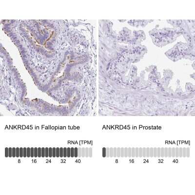 Immunohistochemistry-Paraffin: ANKRD45 Antibody [NBP1-85421]