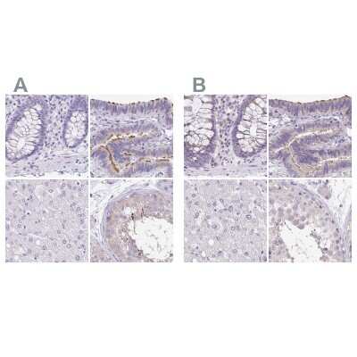 Immunohistochemistry-Paraffin: ANKRD45 Antibody [NBP1-85421]