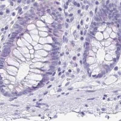 Immunohistochemistry-Paraffin: ANKRD45 Antibody [NBP1-85421]