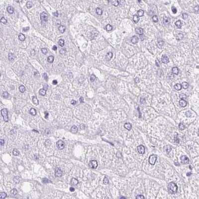 Immunohistochemistry-Paraffin: ANKRD45 Antibody [NBP1-85421]