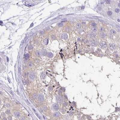 Immunohistochemistry-Paraffin: ANKRD45 Antibody [NBP1-85421]