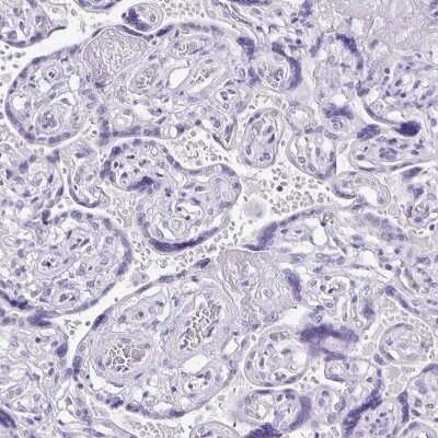 Immunohistochemistry-Paraffin: ANKRD45 Antibody [NBP1-85422]