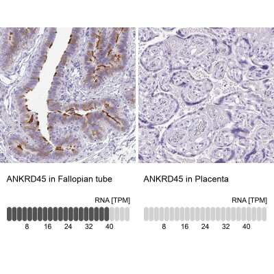 Immunohistochemistry-Paraffin: ANKRD45 Antibody [NBP1-85422]