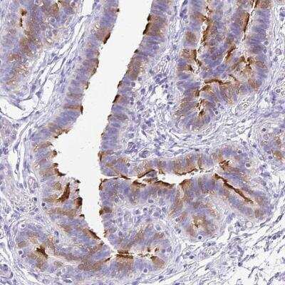 Immunohistochemistry-Paraffin: ANKRD45 Antibody [NBP1-85422]
