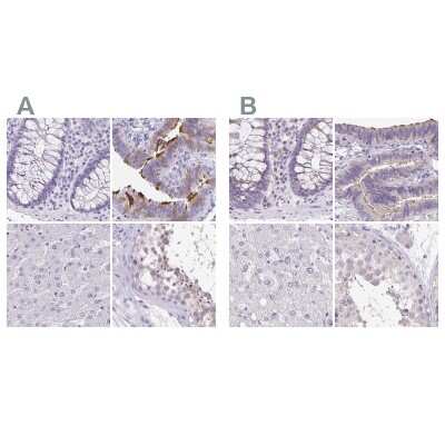 Immunohistochemistry-Paraffin: ANKRD45 Antibody [NBP1-85422]