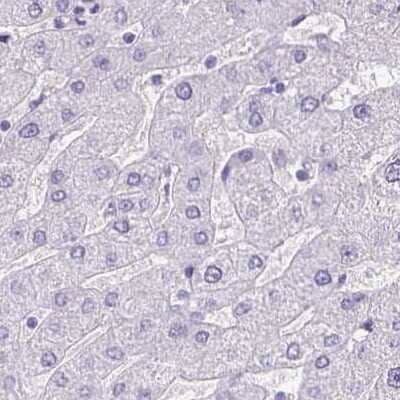 Immunohistochemistry-Paraffin: ANKRD45 Antibody [NBP1-85422]