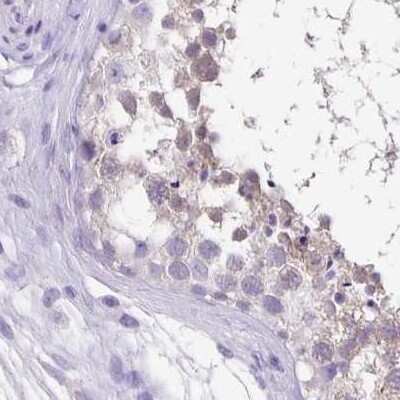 Immunohistochemistry-Paraffin: ANKRD45 Antibody [NBP1-85422]