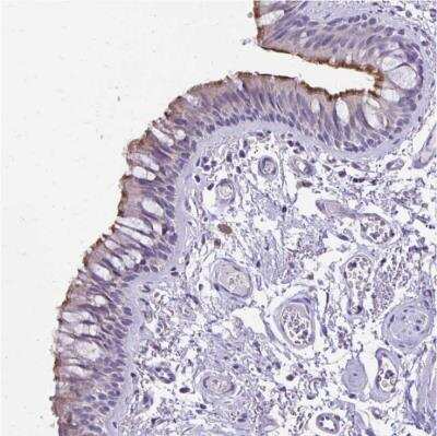 Immunohistochemistry-Paraffin: ANKRD45 Antibody [NBP1-85423]