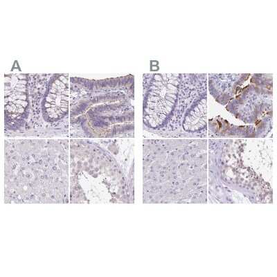 Immunohistochemistry-Paraffin: ANKRD45 Antibody [NBP1-85423]