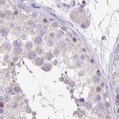 Immunohistochemistry-Paraffin: ANKRD45 Antibody [NBP1-85423]