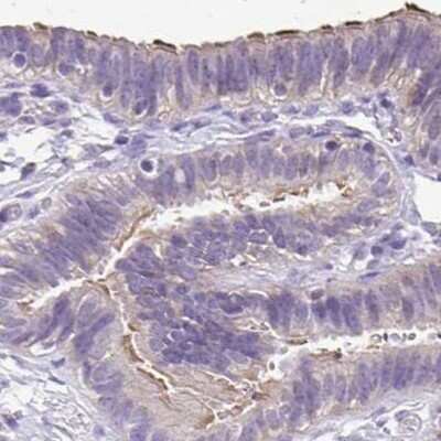 Immunohistochemistry-Paraffin: ANKRD45 Antibody [NBP1-85423]