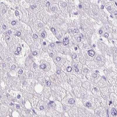 Immunohistochemistry-Paraffin: ANKRD45 Antibody [NBP1-85423]