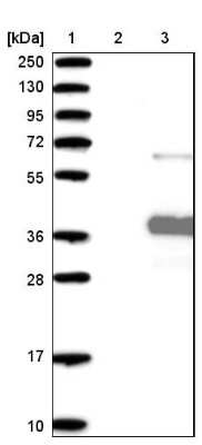 Western Blot: ANKRD45 Antibody [NBP1-85421]