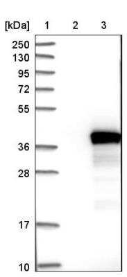 Western Blot: ANKRD45 Antibody [NBP1-85422]