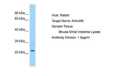 Western Blot: ANKRD46 Antibody [NBP2-82618]